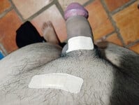 Tỉa lông và cái kết