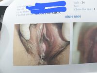 Em gái đi khám phụ khoa