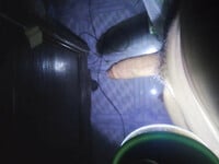 Ảnh hôm qua vs lúc trước bị xóa, ảnh kia mất r nha