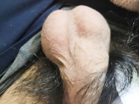 Chym nhỏ lắm lông