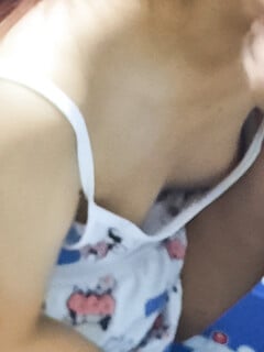 Vú căng thả rong